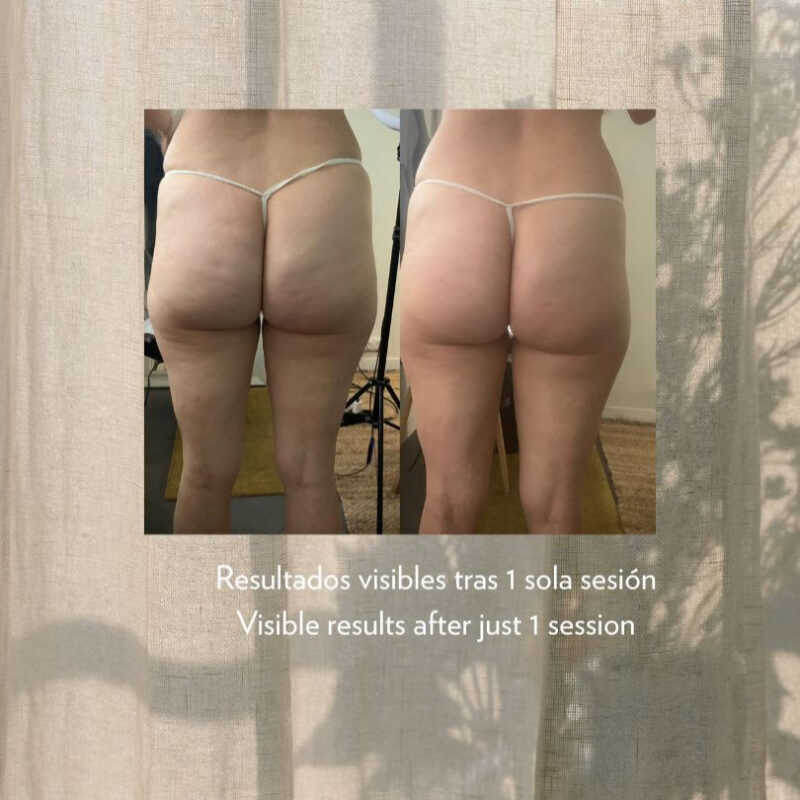 Silk Renew Cream - DAFNA'S - Imagen 6