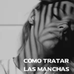 Cómo tratar las manchas