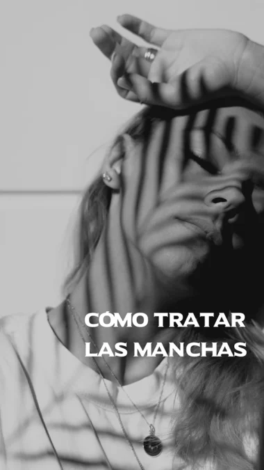 Cómo tratar las manchas